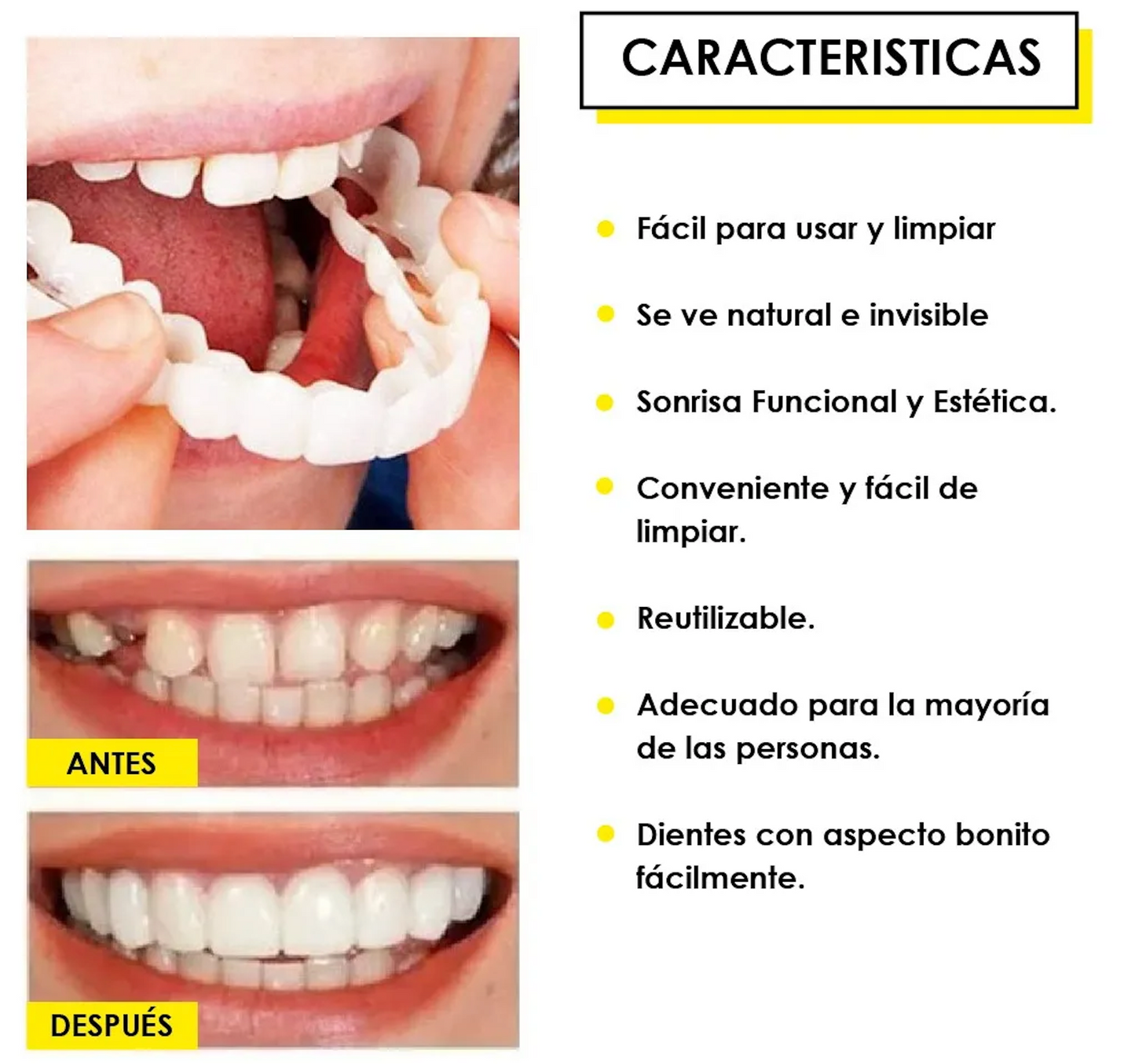 CARILLAS DENTALES SNAPON SMILE