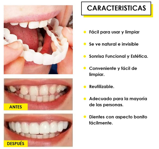 CARILLAS DENTALES SNAPON SMILE